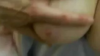 الدكتور ليل آدامز آدامز افلام سكسيه يرضي المريض بالجنس. علاج الصلع.